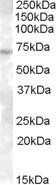 NB100-94888 - ABCE1